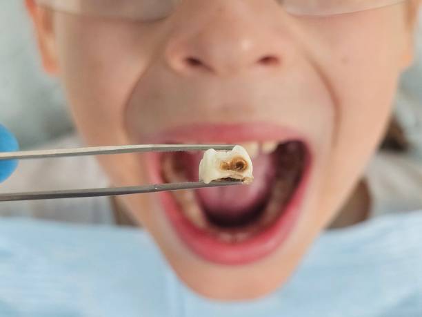  Clarksburg, WV Emergency Dentist Pros